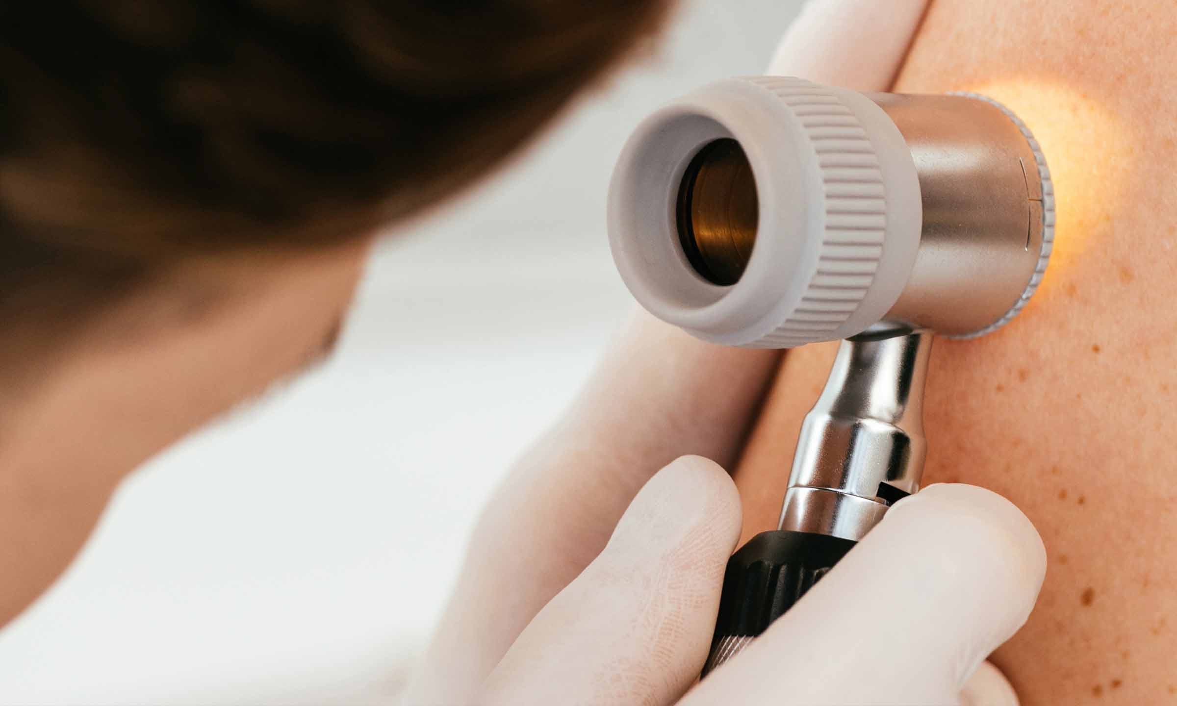 Dermatology